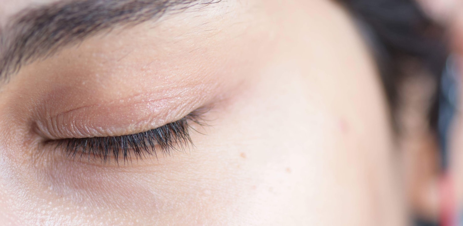 Can you wear contacts with a stye or chalazion? 