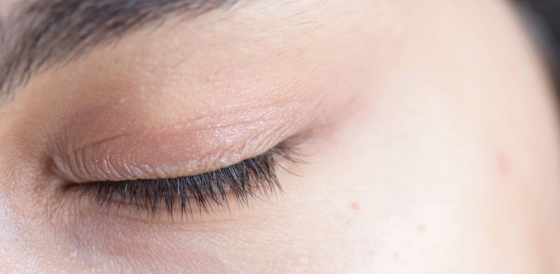 Can you wear contacts with a stye or chalazion?