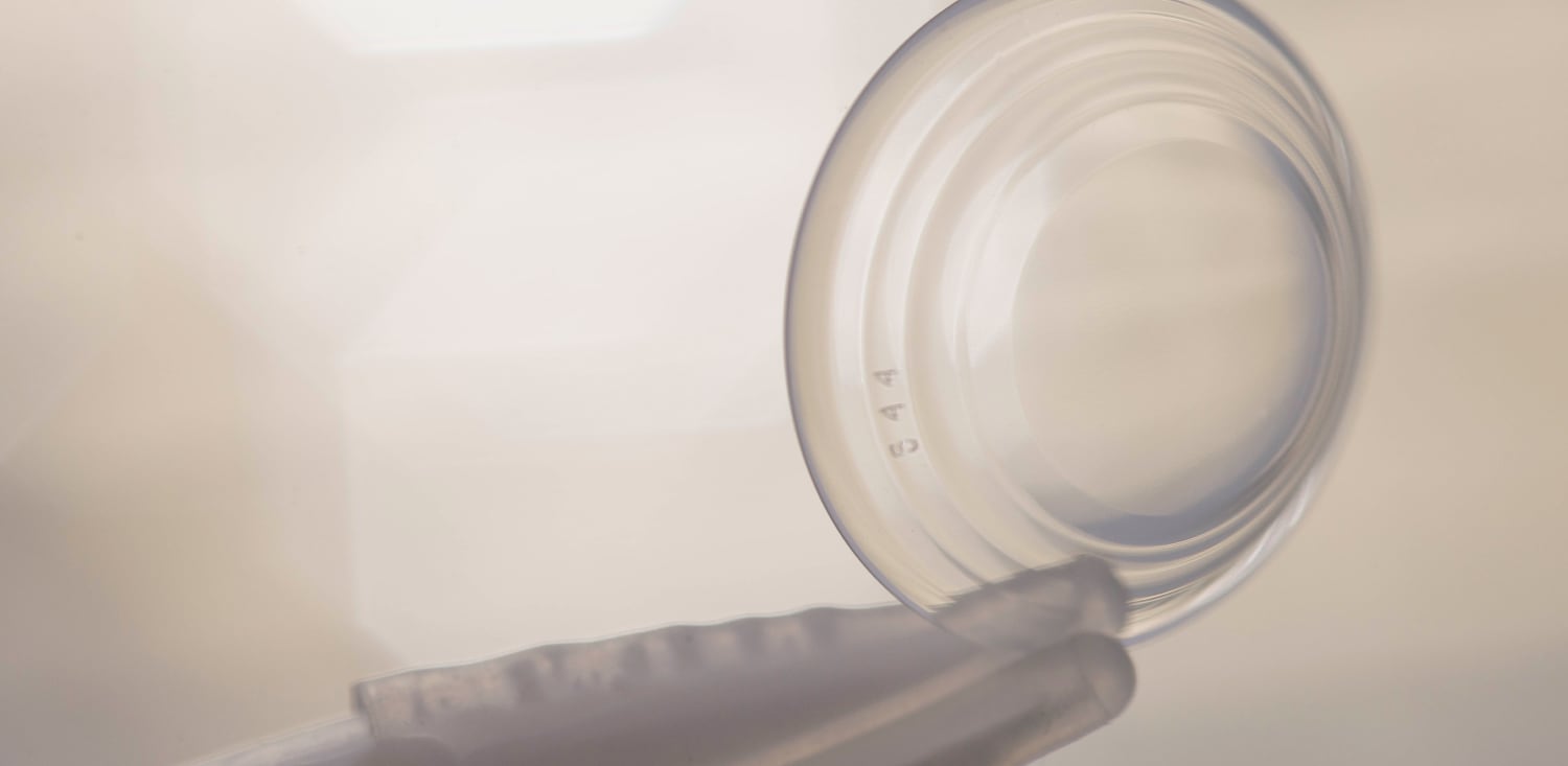 What Are Scleral Contact Lenses?